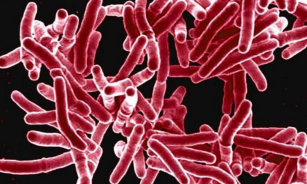 Kansas Faces Major Tuberculosis Outbreak 2 Dead and 146 Infected